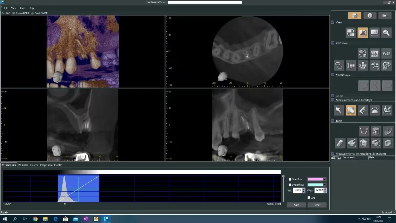 3D cbct